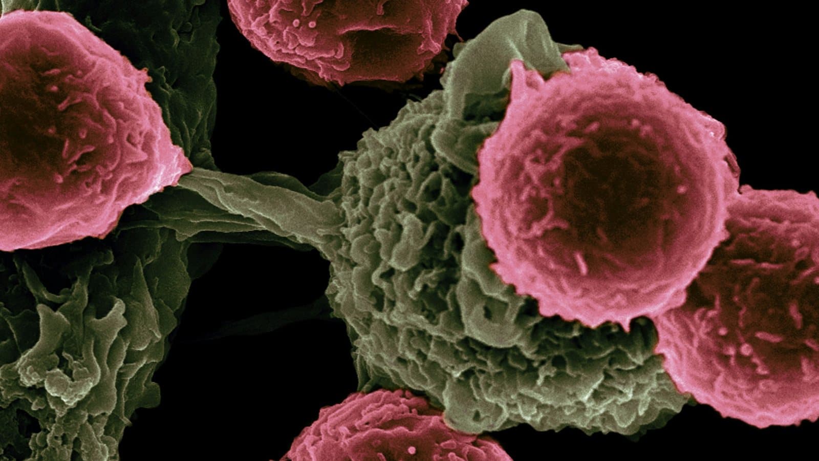 Colorized electron micrograph of immune cells: round pink T cells pressed against a green dendritic cell on a black background.