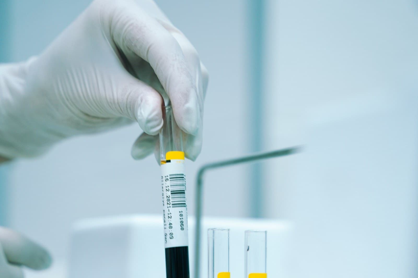 A gloved hand lifting a labeled specimen tube from a rack in a clinical laboratory.